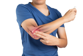 Elbow joint replacement, also known as total elbow arthroplasty, is a surgical procedure designed to relieve pain and restore function in a severely damaged or arthritic elbow joint. 